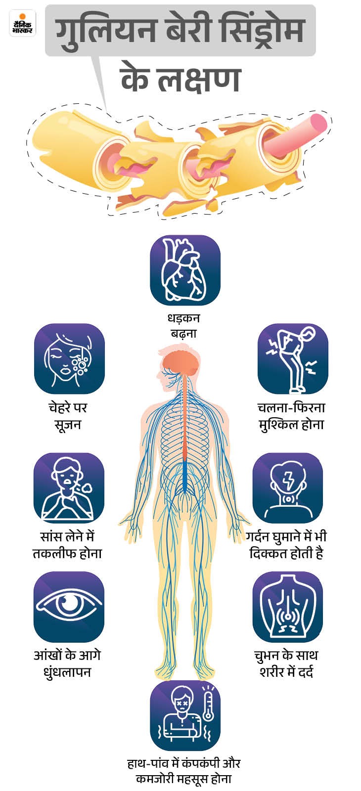 महाराष्ट्रात गुइलेन बॅरे सिंड्रोमचे १११ रुग्ण