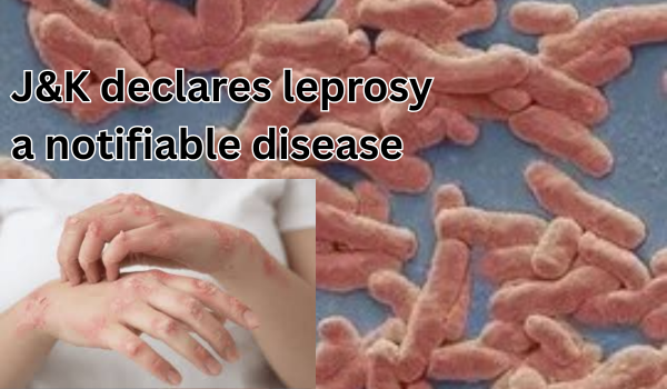 J&K government declares leprosy a notifiable disease with immediate effect