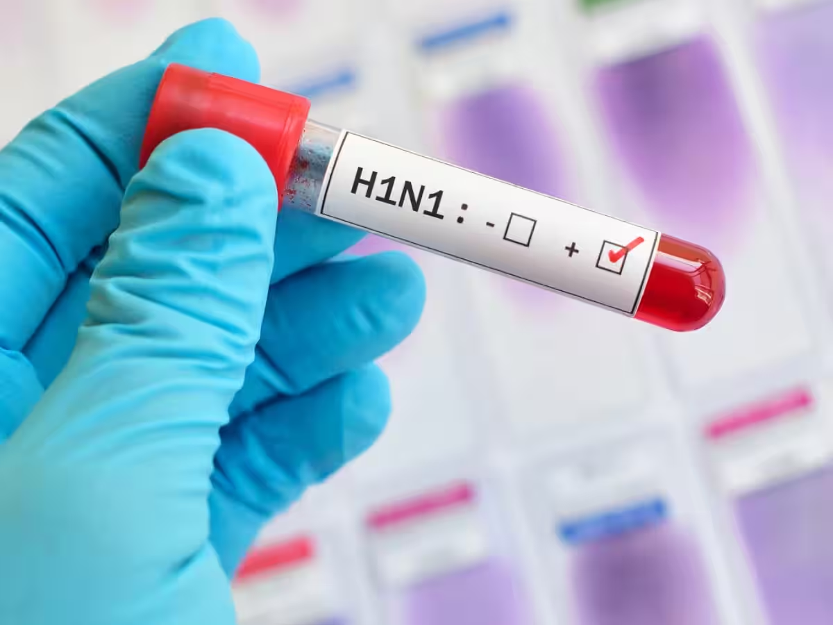 दिल्ली सरकार ने मौसमी इन्फ्लुएंजा- H1N1 और डेंगू को लेकर जागरूकता कार्यक्रम का किया आयोजन